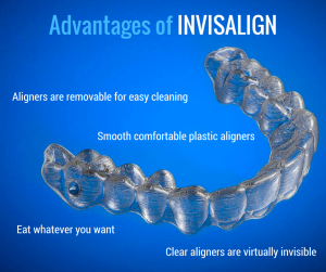 invisalign